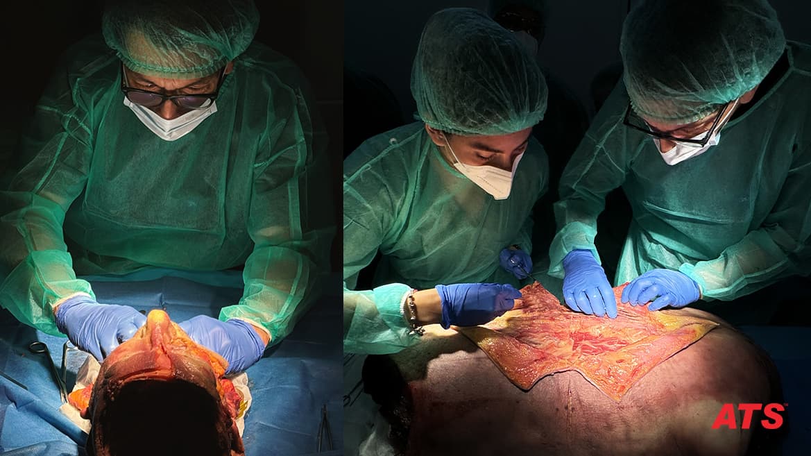 Cadaver Lab — Dissezione Anatomica